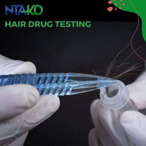 Plaukų tyrimo testų atsakymai
